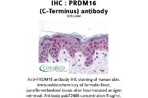 Image no. 1 for anti-PR Domain Containing 16 (PRDM16) (C-Term) antibody (ABIN1738317)