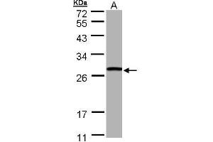 Image no. 3 for anti-Glutathione S-Transferase theta 1 (GSTT1) (full length) antibody (ABIN2856663)