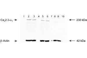 Image no. 1 for anti-Calcium Channel, Voltage-Dependent, R Type, alpha 1E Subunit (CACNA1E) (C-Term) antibody (ABIN350140)