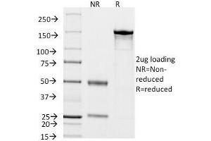 Image no. 6 for anti-Keratin 18 (KRT18) antibody (ABIN3026949)