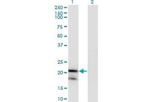 Image no. 2 for anti-Interleukin 1 Receptor Antagonist (IL1RN) (AA 1-159) antibody (ABIN517006)