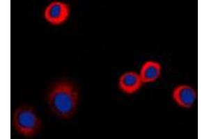 Immunofluorescent analysis of CD120b staining in PC12 cells.