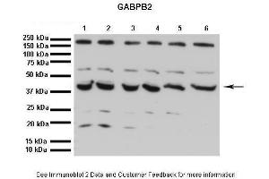 GABPB2 antibody  (C-Term)