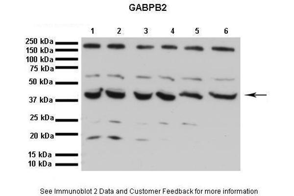 GABPB2 antibody  (C-Term)
