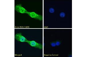 Image no. 5 for anti-Itchy E3 Ubiquitin Protein Ligase Homolog (ITCH) (Internal Region) antibody (ABIN334426)