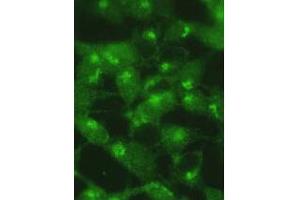 Image no. 2 for anti-Microtubule-Associated Protein 1 Light Chain 3 alpha (MAP1LC3A) (AA 89-120), (cleaved) antibody (ABIN388483)