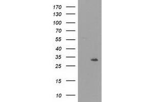 Image no. 1 for anti-Nicotinamide Nucleotide Adenylyltransferase 1 (NMNAT1) antibody (ABIN2727411)