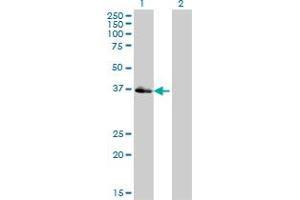 Image no. 6 for anti-POU Domain, Class 4, Transcription Factor 3 (POU4F3) (AA 100-190) antibody (ABIN562325)