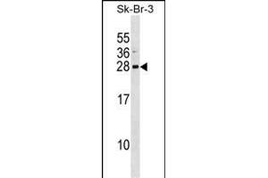 ARL1 Antibody (Center) (ABIN1538637 and ABIN2848485) western blot analysis in SK-BR-3 cell line lysates (35 μg/lane).
