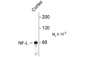 Image no. 1 for anti-Neurofilament, Light Polypeptide (NEFL) antibody (ABIN361353)