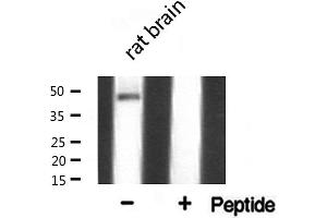 Image no. 1 for anti-Transcription Factor AP-2 alpha (Activating Enhancer Binding Protein 2 Alpha) (TFAP2A) (C-Term) antibody (ABIN6259960)