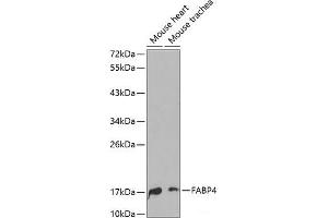 Western blot analysis of extracts of various cell lines using FABP4 Polyclonal Antibody.