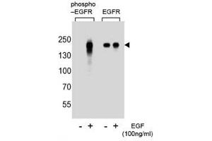 Image no. 5 for anti-Epidermal Growth Factor Receptor (EGFR) (pTyr1172) antibody (ABIN3030845)