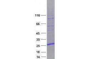 Image no. 1 for Zinc Finger, HIT-Type Containing 3 (ZNHIT3) protein (Myc-DYKDDDDK Tag) (ABIN2736144)