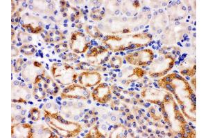 Image no. 3 for anti-Wingless-Type MMTV Integration Site Family, Member 7A (WNT7A) (AA 226-256), (C-Term) antibody (ABIN3042348)