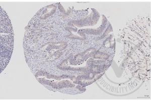 Image no. 2 for anti-V-Raf-1 Murine Leukemia Viral Oncogene Homolog 1 (RAF1) (AA 31-130) antibody (ABIN733208)