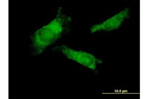 Image no. 2 for anti-Ring Finger Protein 14 (RNF14) (AA 1-348) antibody (ABIN523101)