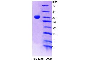 Image no. 1 for Pyridoxamine 5'-Phosphate Oxidase (PNPO) (AA 1-261) protein (His tag) (ABIN6238760)