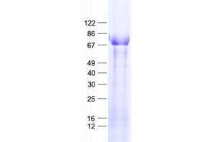 Image no. 1 for Zinc Finger Protein 354B (ZNF354B) protein (His tag) (ABIN2736013)