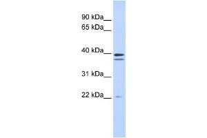 Image no. 1 for anti-Rab Geranylgeranyltransferase, beta Subunit (RABGGTB) (Middle Region) antibody (ABIN2783444)