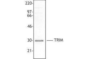 Image no. 1 for anti-T Cell Receptor Associated Transmembrane Adaptor 1 (TRAT1) (AA 29-186) antibody (ABIN205504)