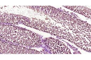 Image no. 1 for anti-TOX High Mobility Group Box Family Member 2 (TOX2) (AA 201-300) antibody (ABIN1387636)