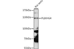 PLEKHG4 抗体  (AA 710-1010)