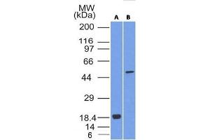 Image no. 1 for anti-SRY (Sex Determining Region Y)-Box 10 (SOX10) (AA 115-269) antibody (ABIN6940624)