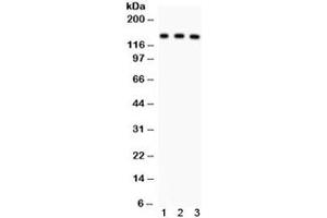 Image no. 1 for anti-ATP-Binding Cassette, Sub-Family B (MDR/TAP), Member 11 (ABCB11) antibody (ABIN4949968)