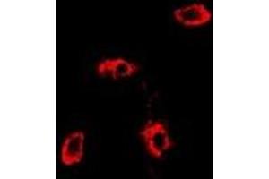 Image no. 1 for anti-RAB11A, Member RAS Oncogene Family (RAB11A) antibody (ABIN2966968)