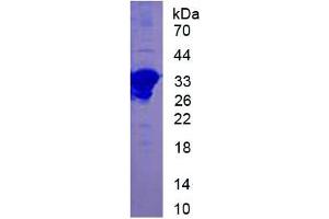 Image no. 4 for Chemokine (C-C Motif) Ligand 7 (CCL7) ELISA Kit (ABIN6574138)