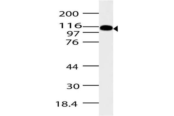 anti-ArfGAP with SH3 Domain, Ankyrin Repeat and PH Domain 2 (ASAP2) (AA 500-760) antibody