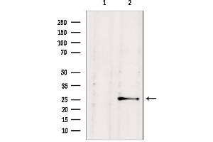 Image no. 1 for anti-Nudix (Nucleoside Diphosphate Linked Moiety X)-Type Motif 21 (NUDT21) (Internal Region) antibody (ABIN6263764)
