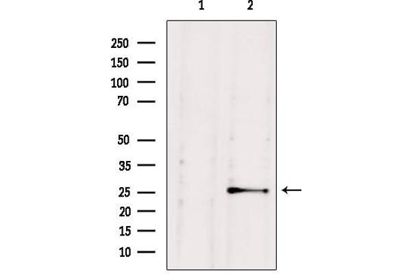 anti-Nudix (Nucleoside Diphosphate Linked Moiety X)-Type Motif 21 (NUDT21) (Internal Region) antibody