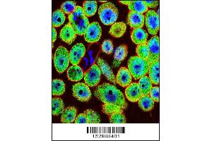 Image no. 2 for anti-Hematological and Neurological Expressed 1 (HN1) (AA 58-86) antibody (ABIN5532572)