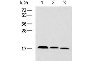 Western blot analysis of Mouse kidney tissue Rat brain tissue Mouse liver tissue lysates using CPLX3 Polyclonal Antibody at dilution of 1:950