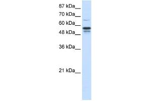 Image no. 1 for anti-Forkhead Box G1 (FOXG1) (N-Term) antibody (ABIN2780667)