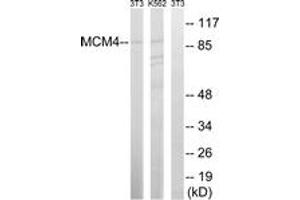 Image no. 1 for anti-Minichromosome Maintenance Deficient 4 (MCM4) (AA 20-69) antibody (ABIN1532597)
