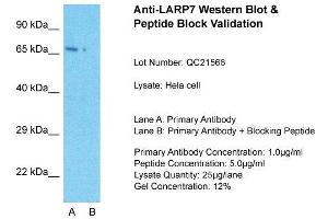Image no. 2 for anti-La Ribonucleoprotein Domain Family, Member 7 (LARP7) (C-Term) antibody (ABIN2779104)