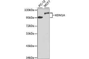 Image no. 1 for anti-Lysine (K)-Specific Demethylase 1A (KDM1A) antibody (ABIN6567175)