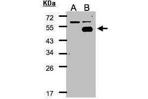 Image no. 3 for anti-Nuclear Receptor Subfamily 2, Group F, Member 1 (NR2F1) (N-Term) antibody (ABIN2855957)