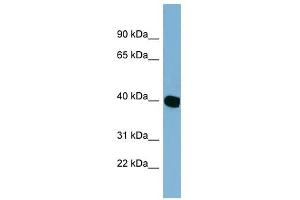 Image no. 1 for anti-Chromosome 14 Open Reading Frame 148 (C14orf148) (Middle Region) antibody (ABIN632026)