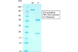 SDS-PAGE Analysis Purified Glypican-3 Mouse Recombinant Monoclonal Ab (rGPC3/863).