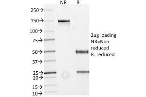 Image no. 1 for anti-Extracellular Matrix Protein 1 (ECM1) antibody (ABIN6939281)