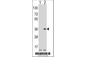 Image no. 2 for anti-Sulfotransferase Family, Cytosolic, 1A, Phenol-Preferring, Member 1 (SULT1A1) (AA 128-160) antibody (ABIN389136)