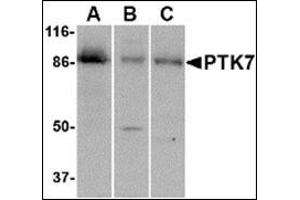 Image no. 2 for anti-PTK7 Protein tyrosine Kinase 7 (PTK7) (C-Term) antibody (ABIN500553)