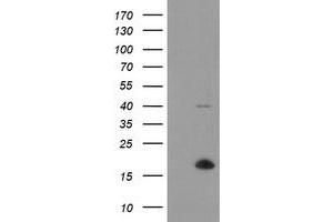Image no. 8 for anti-Tumor Protein D52-Like 3 (TPD52L3) antibody (ABIN1501475)