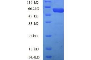 Image no. 1 for Pregnancy Zone Protein (PZP) (AA 472-821) protein (His tag) (ABIN5710197)