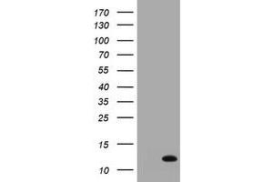Image no. 1 for anti-S100 Calcium Binding Protein A6 (S100A6) antibody (ABIN1500784)