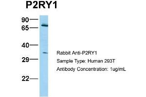 Image no. 2 for anti-Purinergic Receptor P2Y, G-Protein Coupled, 1 (P2RY1) (N-Term) antibody (ABIN2784500)